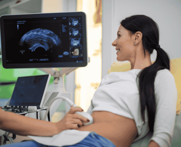 3D:4D Ultrasound with Color Doppler