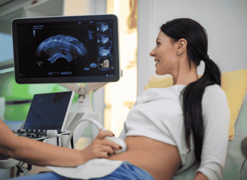 3D:4D Ultrasound with Color Doppler