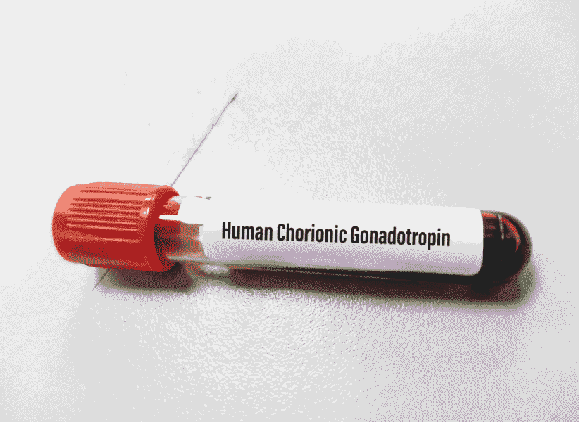 CVS (Chorionic Villus Sampling)