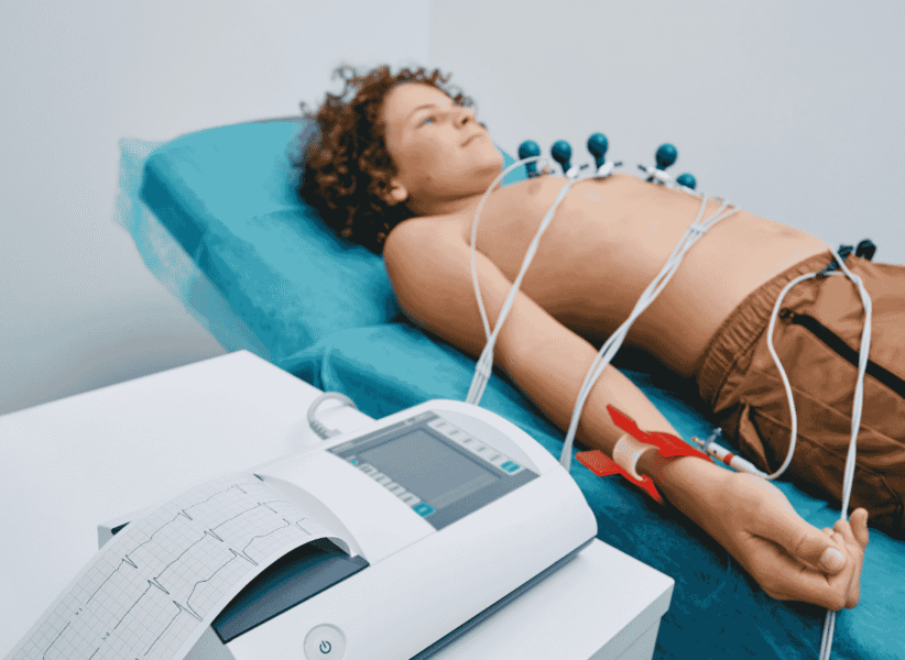 ECG