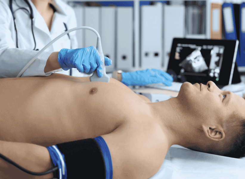 ECHO (Echocardiography)