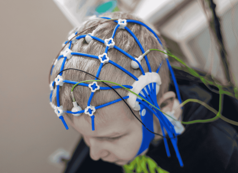 EEG (electroencephalogram)-