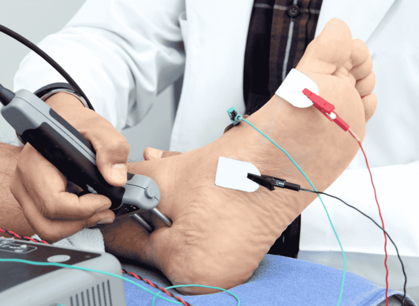 NCV (A nerve conduction velocity)-